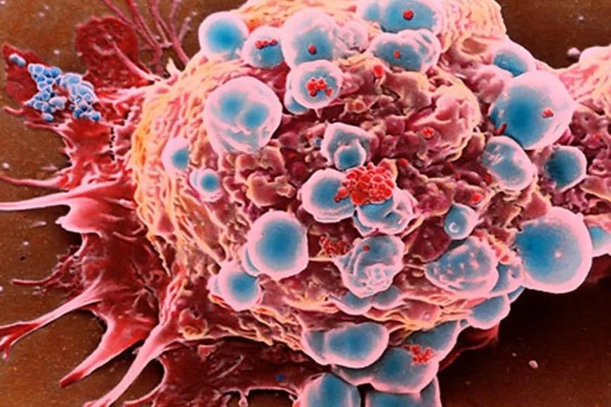 Kanserin En Sık Görüldüğü İki İl