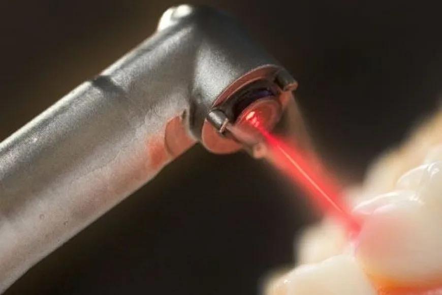 Diş Tedavilerinde Lazer Uygulaması Güvenli Mi?
