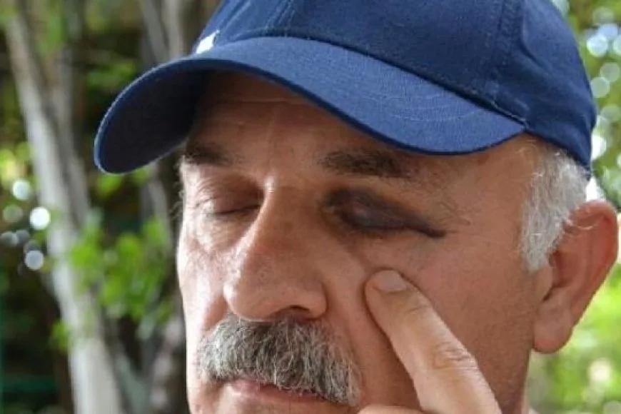 Diş Hekimi Hastasına Saldırdı Diye Suçlandı