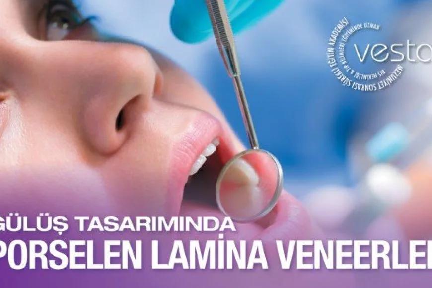 Gülüş Tasarımında Porselen Lamina Veneer Uygulama Eğitimi