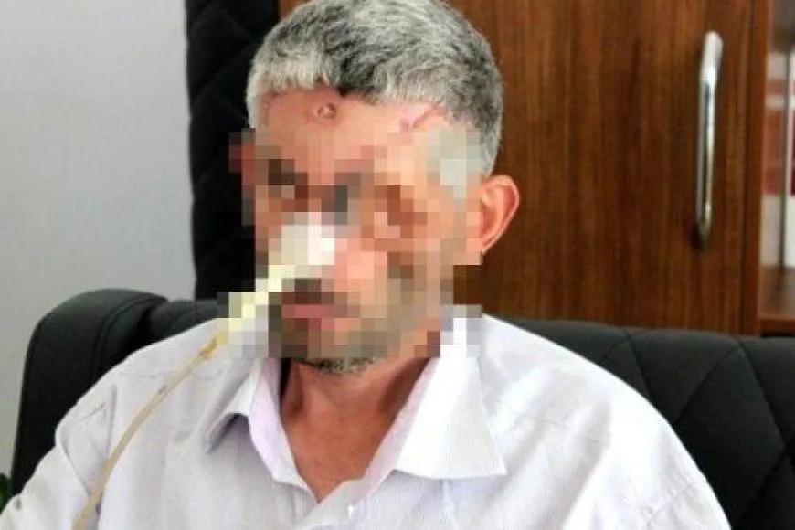 Dişini Çektirdikten Sonra Sol Gözünü Kaybetti İddiasına Yalanlama