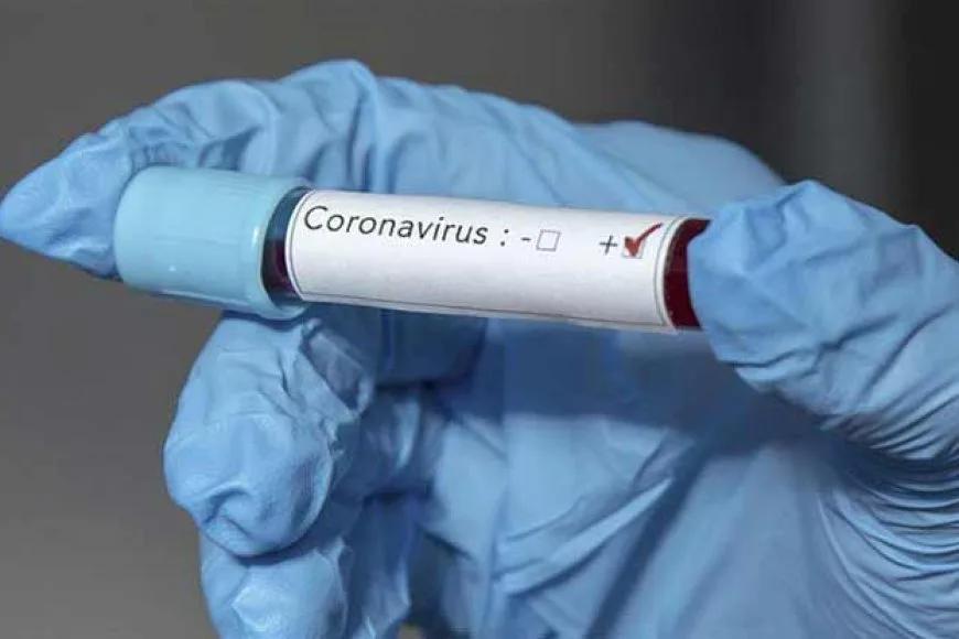 Dünyada Corona virüs nedeniyle ölenlerin sayısı 18 bin 900'ü aştı