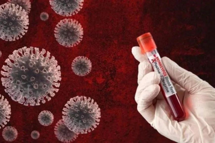 Nijerya'da M çiçeği vaka sayısı artıyor