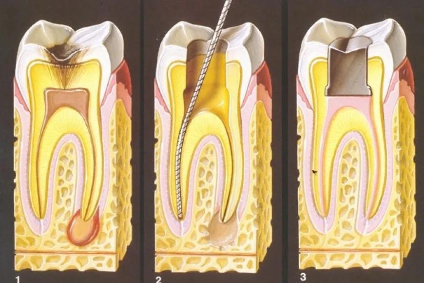 12. Uluslararası Endodonti Kongresi