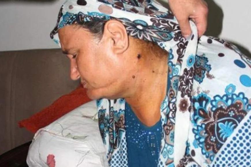 Protez Hayatını Kurtardı