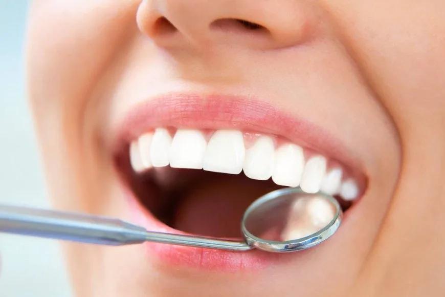 Gülüş Tasarımında Porselen Lamina Veneer Uygulama Eğitimi