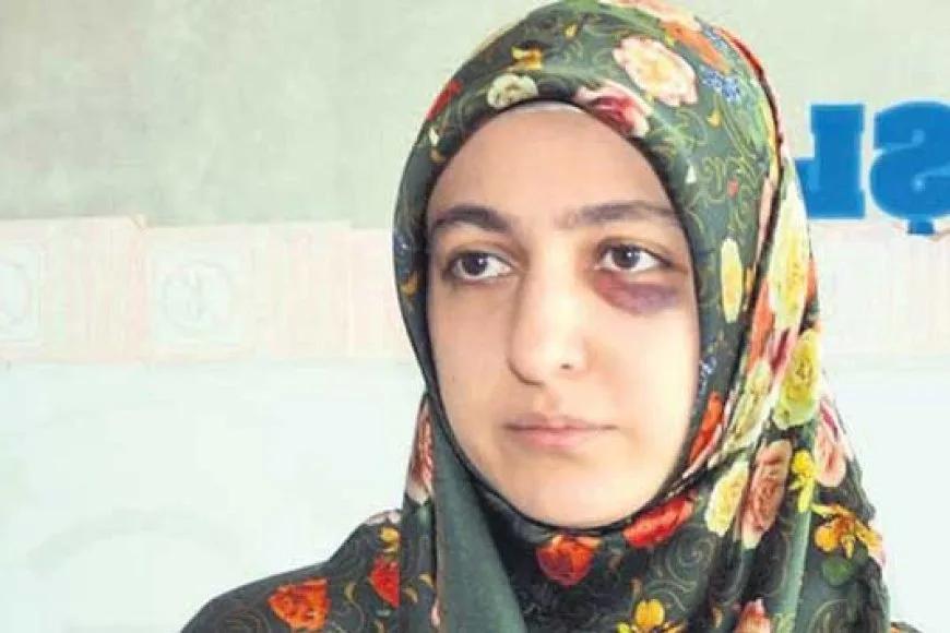 Şiddete Uğrayan Diş Hekimi: "Bu Saldırgan En Ağır Ceza İle Cezalandırılmalı Ki Herkese Örnek Olsun"