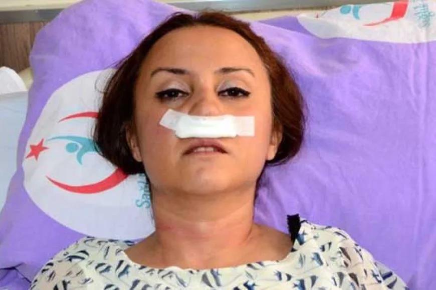 Şikayetini Geri Almayan Doktorun Burnunu Kırdı