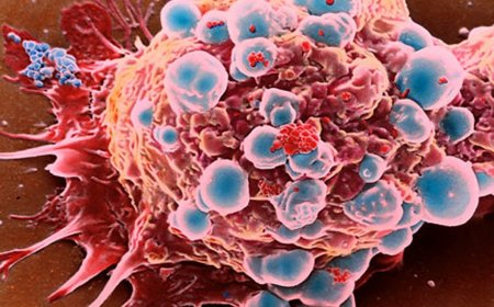 Kanserin En Sık Görüldüğü İki İl
