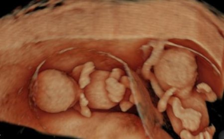 Ultrasonda Mucize; 4 Boyutlu Görüntü