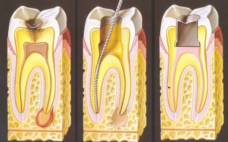 12. Uluslararası Endodonti Kongresi