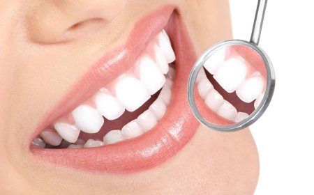 Anterior Estetik Kompozit Dolgular
