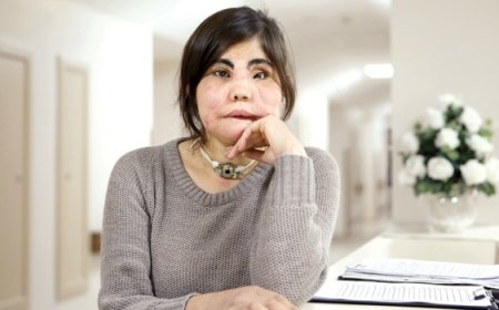 Türkiye'deki İlk Yüz Nakli Yapılan Kadın