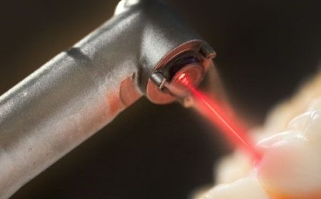 Diş Tedavilerinde Lazer Uygulaması Güvenli Mi?