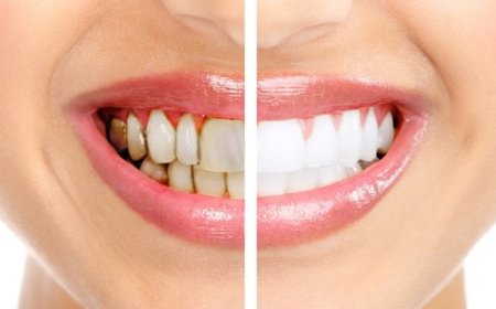 Doğru Ağız Hijyeni Nasıl Sağlanır?