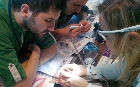 Gülüş Tasarımında Porselen Lamina Veneerler