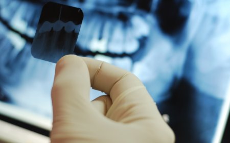 Dental Röntgen Tarih Olacak