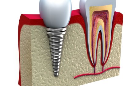 Diş Hekimlerine Ücretsiz "Periodontoloji ve Oral İmplantoloji" Eğitimi