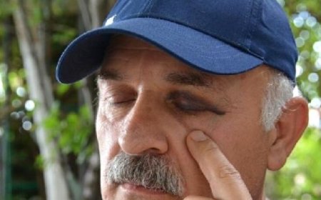 Diş Hekimi Hastasına Saldırdı Diye Suçlandı