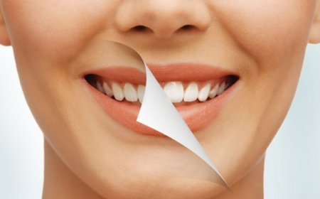 Dünyaca Ünlü İsimler Gülüş Estetiği İçin Türkiye'yi Tercih Ediyor