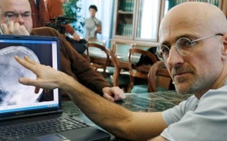 Gerekli Parayı ve İzni Verin İlk Kafa Naklini Gerçekleştireyim