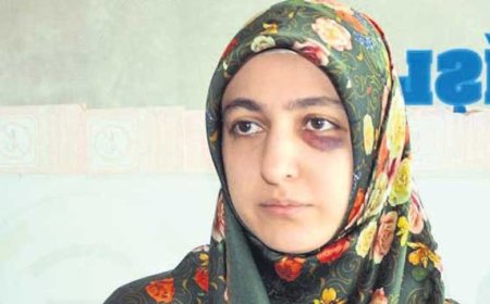 Şiddete Uğrayan Diş Hekimi: "Bu Saldırgan En Ağır Ceza İle Cezalandırılmalı Ki Herkese Örnek Olsun"
