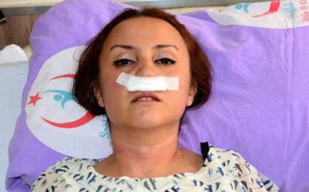 Şikayetini Geri Almayan Doktorun Burnunu Kırdı