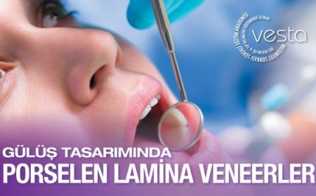Gülüş Tasarımında Porselen Lamina Veneer Uygulama Eğitimi