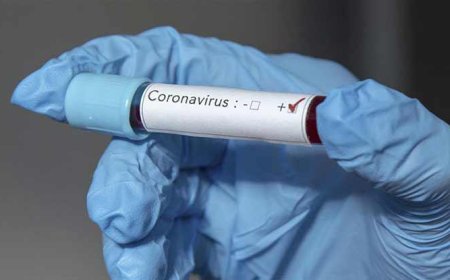 Dünyada Corona virüs nedeniyle ölenlerin sayısı 18 bin 900'ü aştı