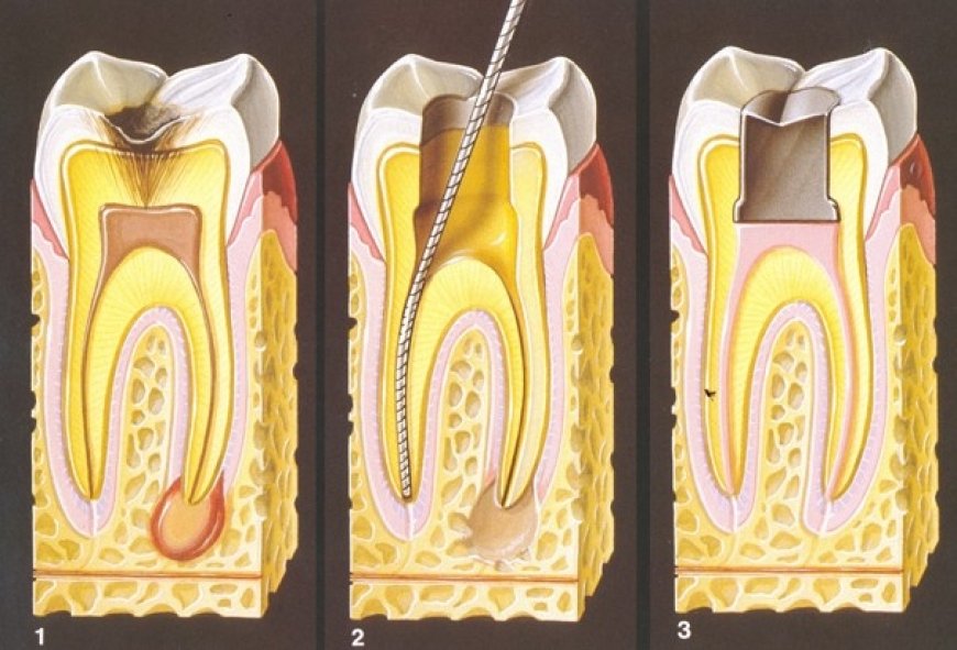 12. Uluslararası Endodonti Kongresi