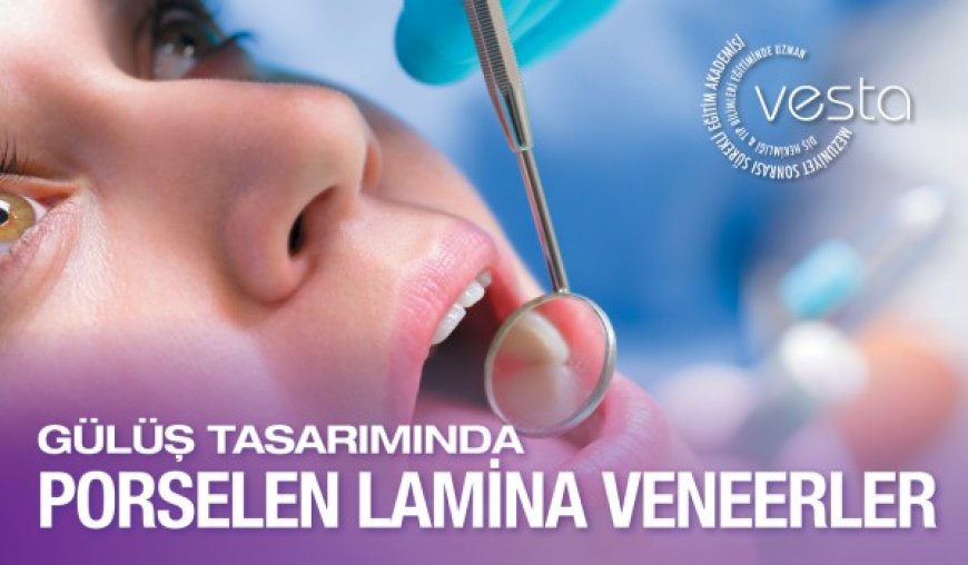 Gülüş Tasarımında Porselen Lamina Veneer Eğitimi