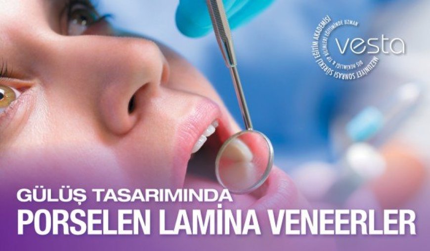 Gülüş Tasarımında Porselen Lamina Veneer Uygulama Eğitimi